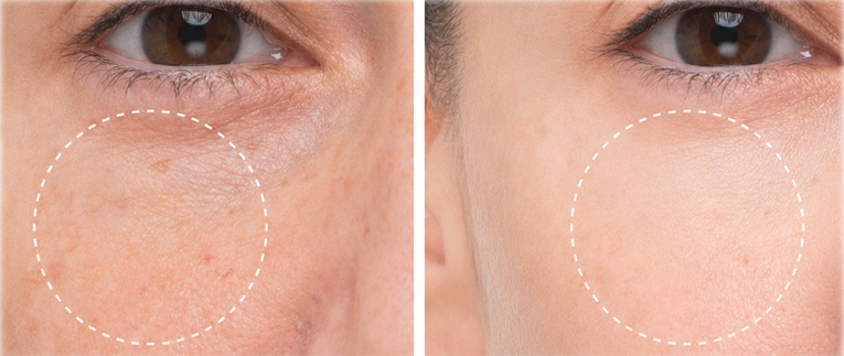 Best Under Eye Serum in Pakistan (2026 Guide)