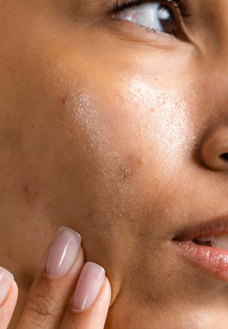 Uneven Tone & Dullness