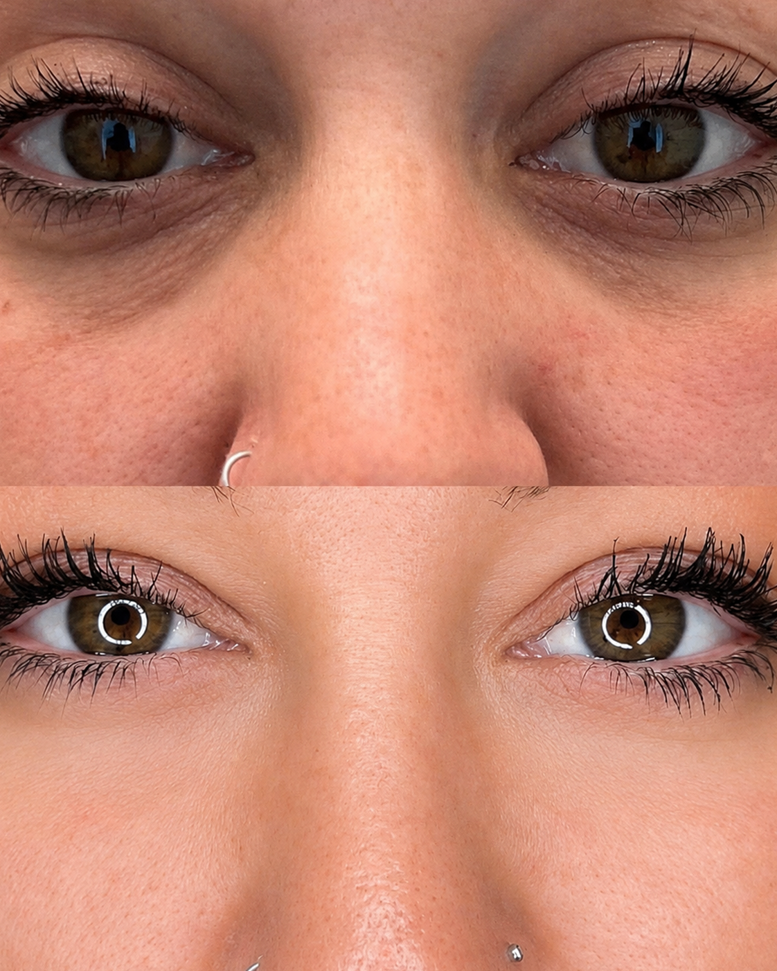 Glow by Zyra Advanced Under Eye Care Serum for dark circles and puffiness in Pakistan