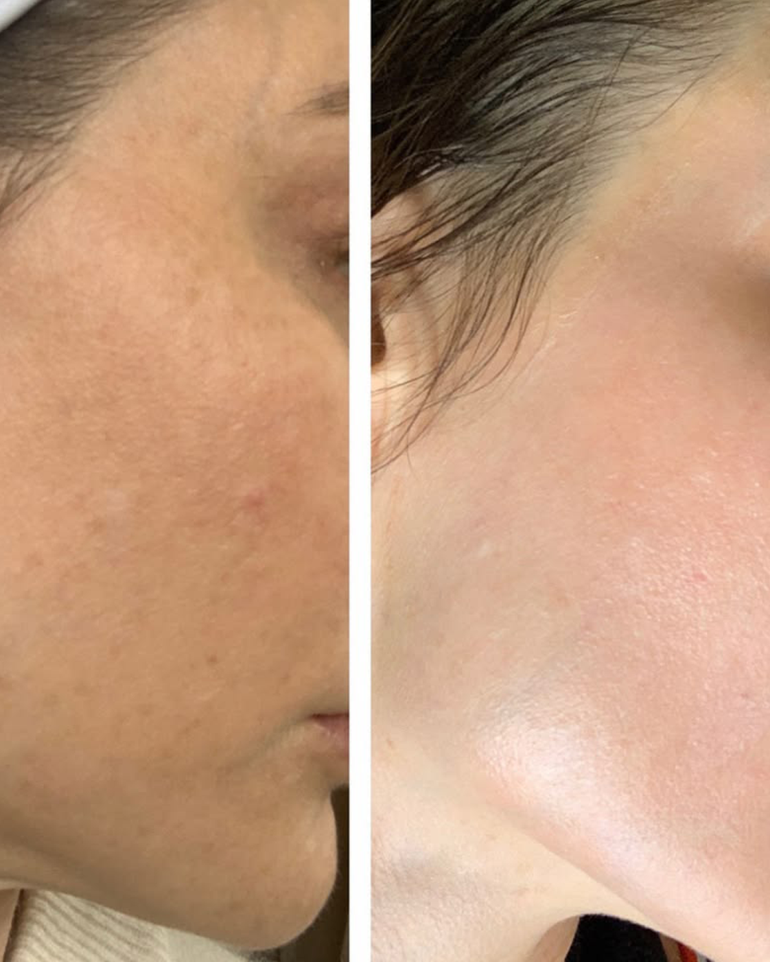 Renewal Cream by Zyra