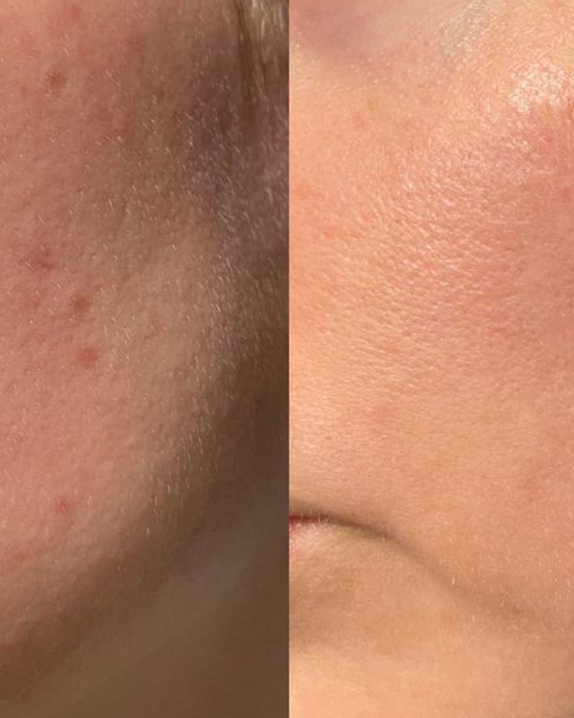 Renewal Cream by Zyra