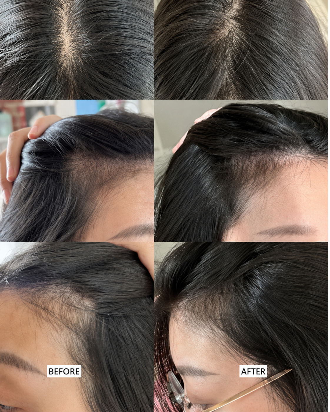 Scalp Clarifying Shampoo by Zyra