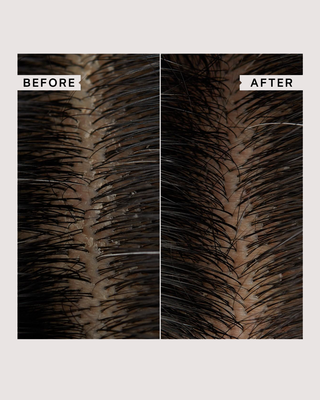 Scalp Clarifying Shampoo by Zyra
