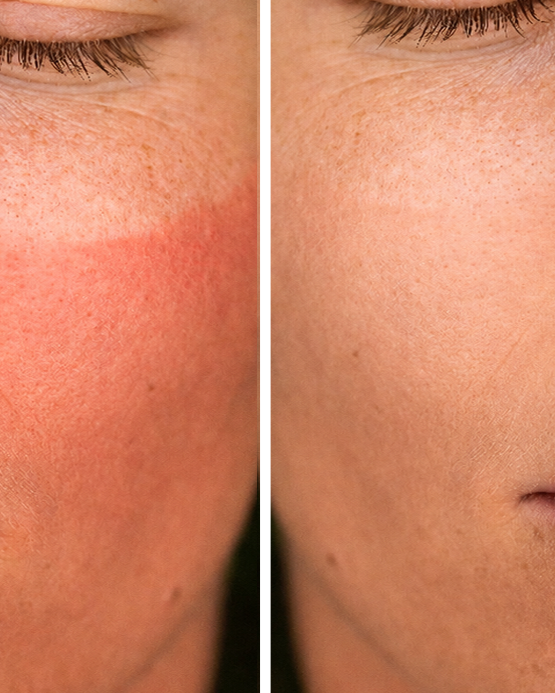 Tinted Sunscreen SPF 30 by Zyra